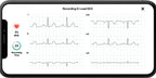 AliveCor KardiaMobile 6L Personal EKG Monitor, Black - KM-6L-E