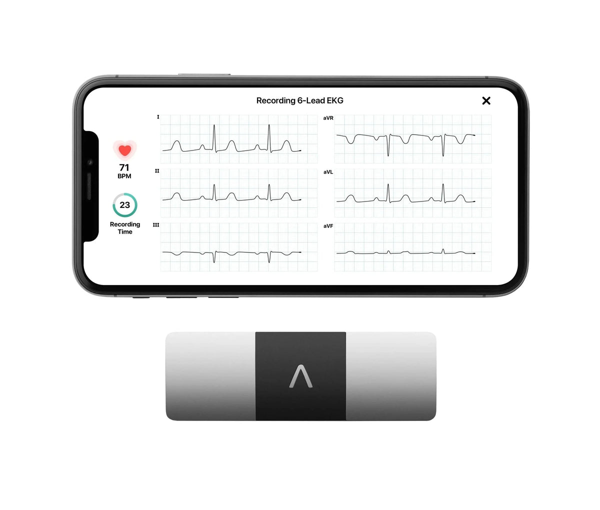 AliveCor KardiaMobile 6L Personal EKG Monitor, Black - KM-6L-E