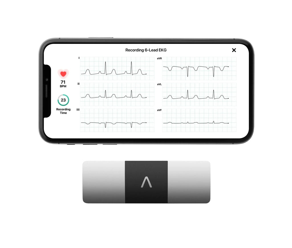 AliveCor KardiaMobile 6L Personal EKG Monitor, Black - KM-6L-E