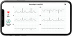 AliveCor KardiaMobile 6L Personal EKG Monitor, Black - KM-6L-E